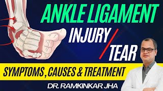 Ankle ATFL Ligament Tear Injury Causes Symptoms and Treatment [upl. by Nnairek390]