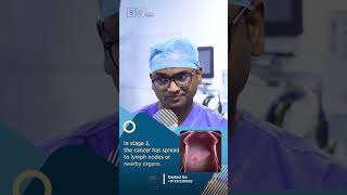 Liver Metastasis in Stage 4 Cancer Key Differences and What They Mean  Dr Praveen Kammar [upl. by Fatimah]