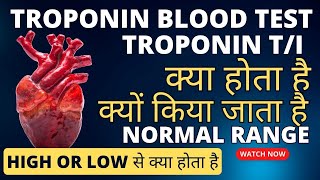 Troponin test in hindi  Troponin t test  troponin test normal range  troponin i test [upl. by Lindberg226]