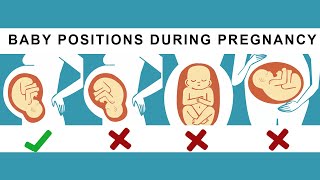 What is Anterior Posterior Breech and Transverse lie [upl. by Tingley868]