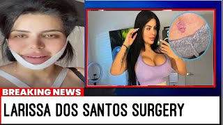 90 Day Fiance’s Larissa Dos Santos Lima’s Plastic Surgery Journey Liposuction to Botched Procedure [upl. by Amej]