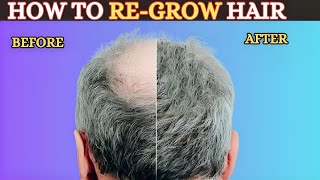 How to Regrow Your Hair UPDATED VITAL INFO in 2023  The Fit Foodie [upl. by Ewart]