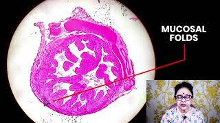 Histology of Uterine Tube Fallopian Tubes  Dr Sibani Mazumder [upl. by Perseus]