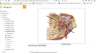 tutorial preguntas de imagen Moodle [upl. by Gillett653]