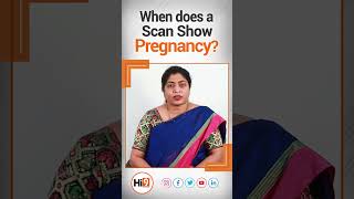 When Does a Scan Show Pregnancy  Dr Muthineni RajiniSr GynecologistampObstetrician  Hi9 [upl. by Casandra]