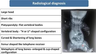 Thanatophoric Dysplasia  Spot Diagnosis  2  Pediatrics [upl. by Granlund828]