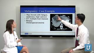 Causes of High Calcium  Masha Livhits MD amp Michael Yeh MD  UCLAMDChat [upl. by Essirahc]