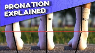 What is overpronation  Pronation types explained [upl. by Entruoc148]