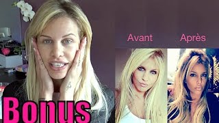 ADIXIA LMSA quotJai trop abusé de la chirurgie jétais plus la même 💉quot INÉDIT [upl. by Ecnerolf625]