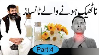 Tonsils  Causes amp treatment of Tonsils Infection  Homeopathic DRMMUNAWAR DAWOOD [upl. by Eissed881]