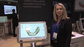 Occlusogram on the iTero Element® 2 Intraoral Scanner [upl. by Clifford122]