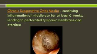 Otitis Externa and Otitis Media [upl. by Newberry]