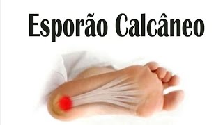 Esporão Calcâneo  Sintomas Causas e Tratamento  Dr Noé de Toledo esporãodecalcâneo [upl. by Olodort145]