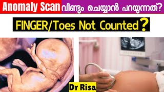 Anomaly Scan Malayalam  5th Month Pregnancy Scan [upl. by Curnin]