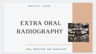 EXTRA ORAL RADIOGRAPHY [upl. by Cynthea]