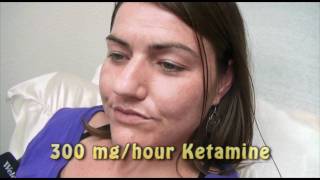 3Day Ketamine Treatment for Complex Regional Pain Syndrome [upl. by Auqinat421]