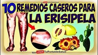 10 Remedios Caseros para la Erisipela  Tratamiento para la Erisipela 😷✔✔ [upl. by Tiduj]