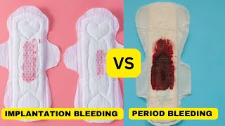 lmplantation bleeding vs periodimplantation bleedingimplantation bleeding or period [upl. by Nnasor541]