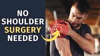 How to TREAT a Rotator Cuff Injury WITHOUT Surgery [upl. by Pinchas]