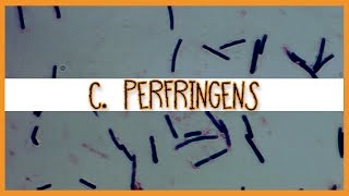 Clostridium Perfringens [upl. by Froh481]