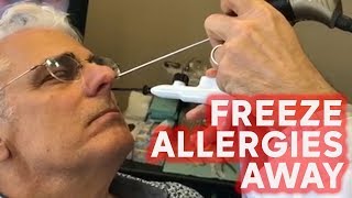 Freeze your allergies away with this treatment [upl. by Eanar]