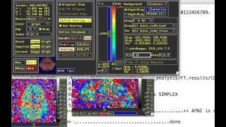 PsychoPhysiological Interactions or PPI aka ContextDependent Correlations [upl. by Esiuole]