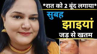 कितनी भी पुरानी झाइयां Pigmentation जड़ से खत्म करो  How to Remove Pigmentation amp Dark Spots [upl. by Lenox]