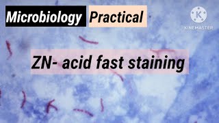 ZN ACID FAST STAINING microbiology practical [upl. by Forrer881]