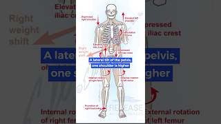 What causes body imbalances [upl. by Markos241]