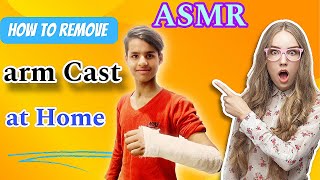 DIY Arm Cast Removal Safe amp Simple Steps at Homequot ASMR [upl. by Llewsor287]