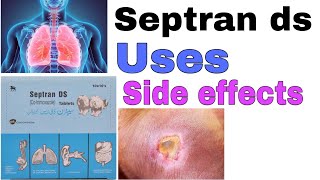 Septran ds tablets  how to use Cotrimoxazole  uses  side effects  precautions in urdi hindi [upl. by Freemon125]