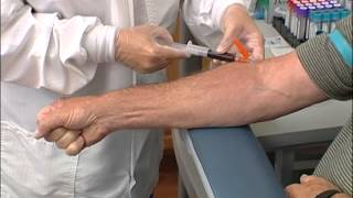 How to perform a venipuncture using a syringe [upl. by Bonn]