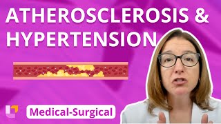 Atherosclerosis and Hypertension  MedicalSurgical  Cardiovascular System  LevelUpRN [upl. by Atener43]