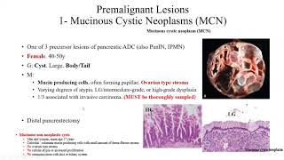 Pathology Made EasySystemic Pathology 2 GIT diseases8Pancreatic Diseases2 [upl. by Ainehta]