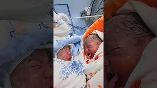 Cute Newborn twin baby 🥰 after birth Ep23 cute newborn twin shortsfeed [upl. by Iam]