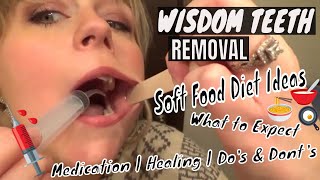 WISDOM TEETH REMOVAL VLOG  WHAT TO EXPECT  FOOD IDEAS [upl. by Bogey898]