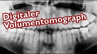 Was ist ein DVT Digitaler Volumentomograph [upl. by Azilef]