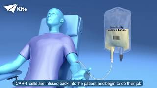 CAR TCell Therapy How Does It Work [upl. by Namwob]