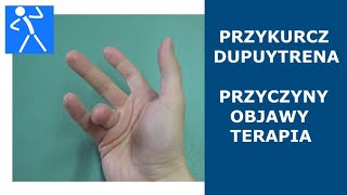 Przykurcz Dupuytrena Przyczyny objawy i terapia 🇵🇱 🇪🇺 [upl. by Arracot513]