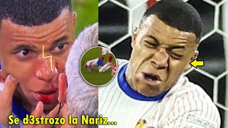 ASI FUE el TERRIBLE CHOQUE de MBAPPE SE ROMPIO  FRANCIA VS AUSTRIA 10 HOY [upl. by Niamrej185]