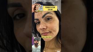 Pigmentation remove cream pakistan ki no1 pigmentation cream Goree cream shortvideo shorts short [upl. by Boylston396]