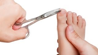 How to Cut Toenails Properly  Foot Care [upl. by Damon]