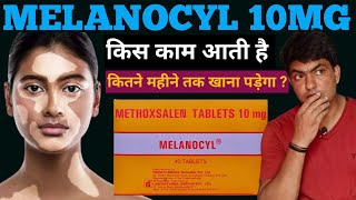 melanocyl tablet uses in hindi  melanocyl tablet side effects  melanocyl 10 mg  methoxsalen [upl. by Neryt]