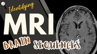 Identifying MRI Brain Sequences [upl. by Lebasiairam18]