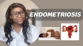 ENDOMETRIOSIS AND INFERTILITY  causes symptoms diagnosis and treatment of endometriosis [upl. by Suoivart]