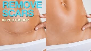 How to Remove a Scar in Photoshop [upl. by Akiem847]