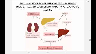 SGLT 2 Inhibitor Associated euglycemic Diabetic Ketoacidosis [upl. by Nimzzaj]