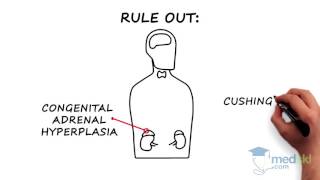 Endocrinology  Hirsutism and Hypertrichosis By Joshua Lakoff MD [upl. by Jsandye]