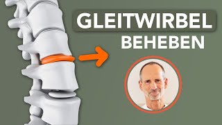 Was du bei Gleitwirbel tun kannst um dir selbst zu helfen gegen Rückenschmerzen [upl. by Nnaecarg]