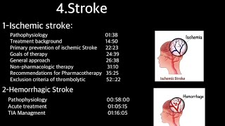 Pharmacotherapy of Stroke  Arabic [upl. by Laveen737]